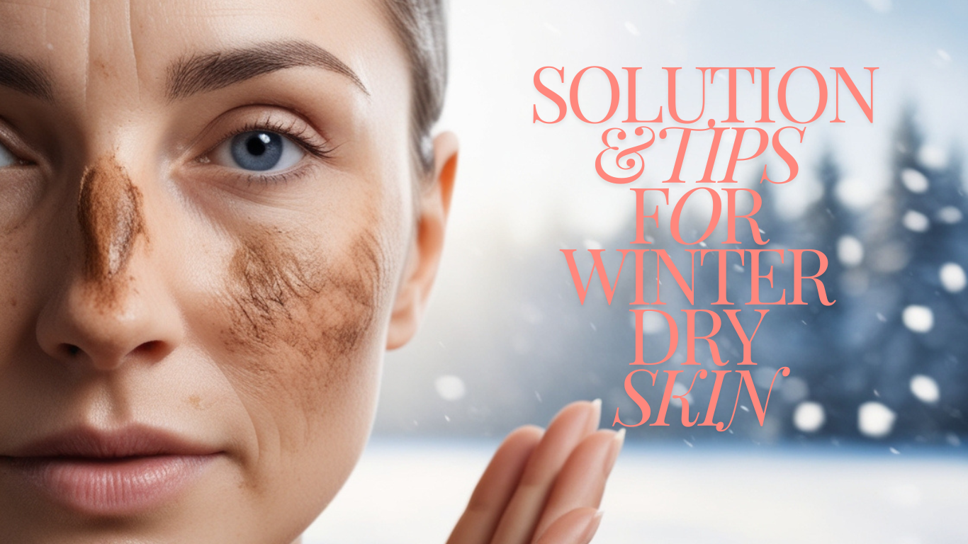 Winter Dry Skin